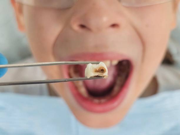 Best Mobile Emergency Dentist in Kadelphia, AR